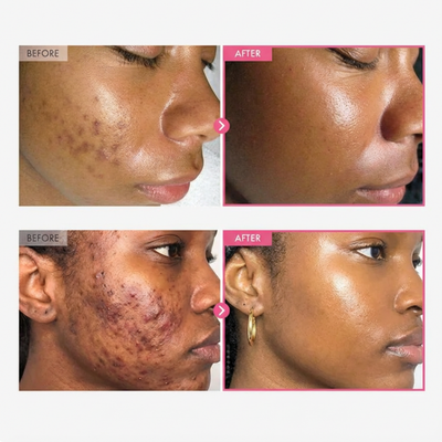 Melanin Logic 7/4™ Correction Cream