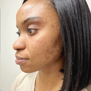 Week 5 Transformation